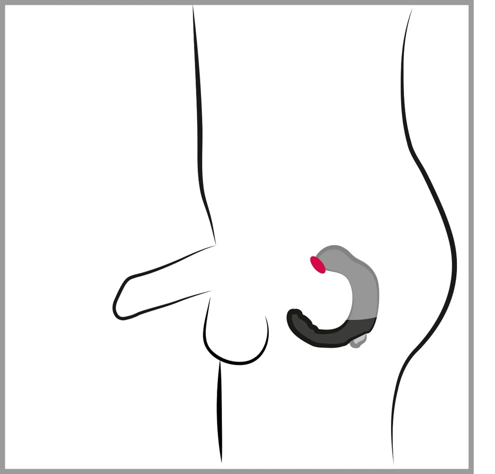 C-vormige prostaatstimulator met perineummassage