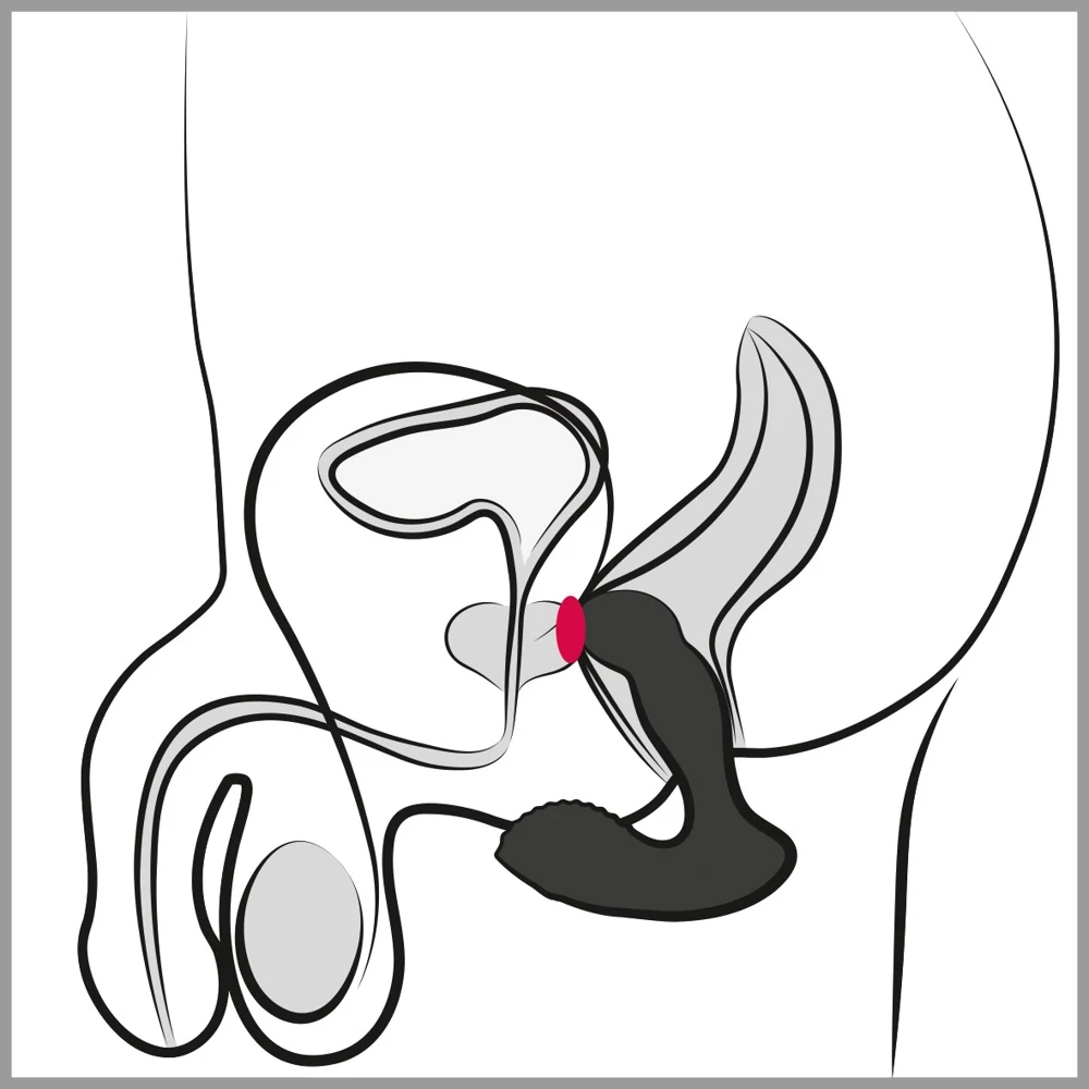 RC Prostate Massager met afstandsbediening