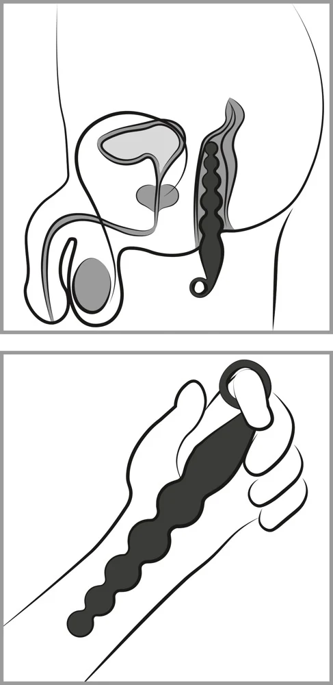 Anaalkralen met vibratie
