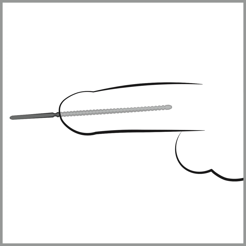 Urethrale dilatator van roestvrij staal 24 cm