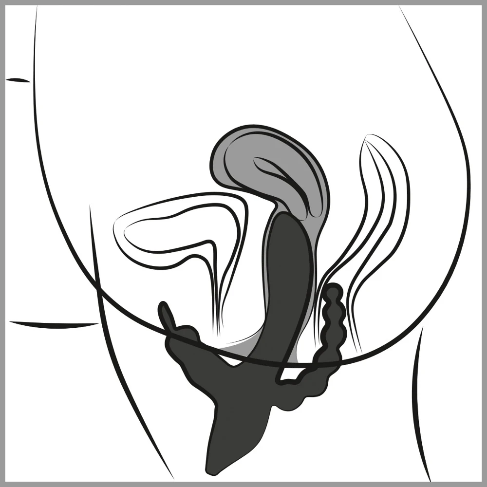 Rabbit vibrator met clitoris- en anusstimulator