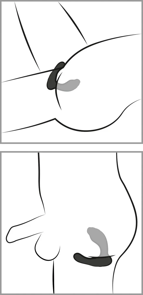 Sweet Smile RC G- & P-Spot Vibrator met Afstandsbediening