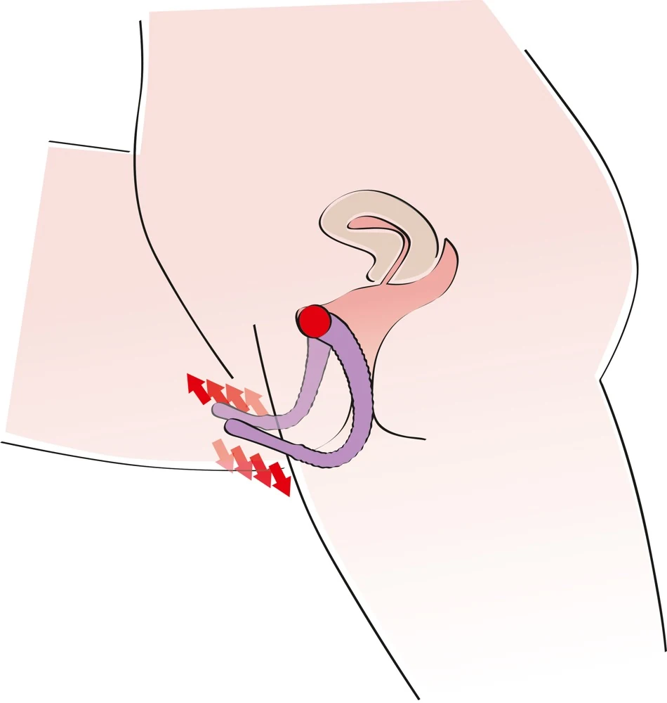 Labia spreider met siliconen afwerking