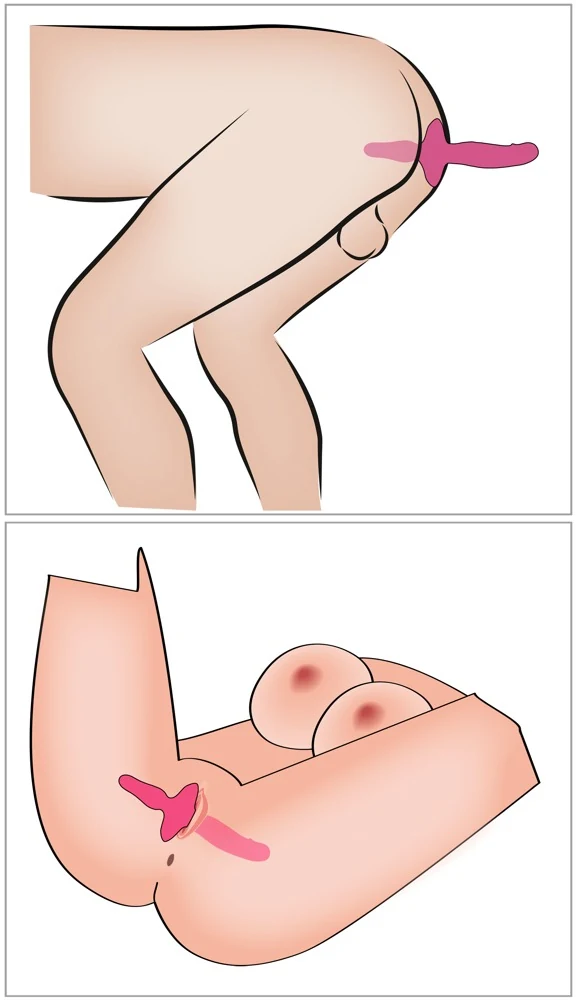 2-in-1 vibrator en buttplug