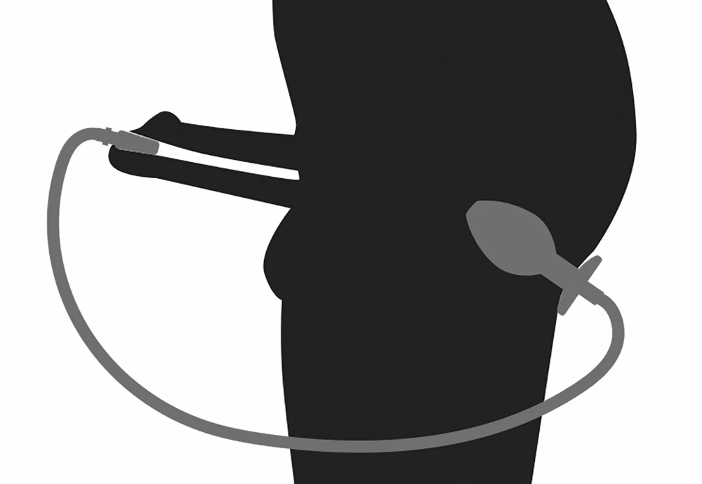 Roestvrijstalen anaalplug met urethrale plug en slang