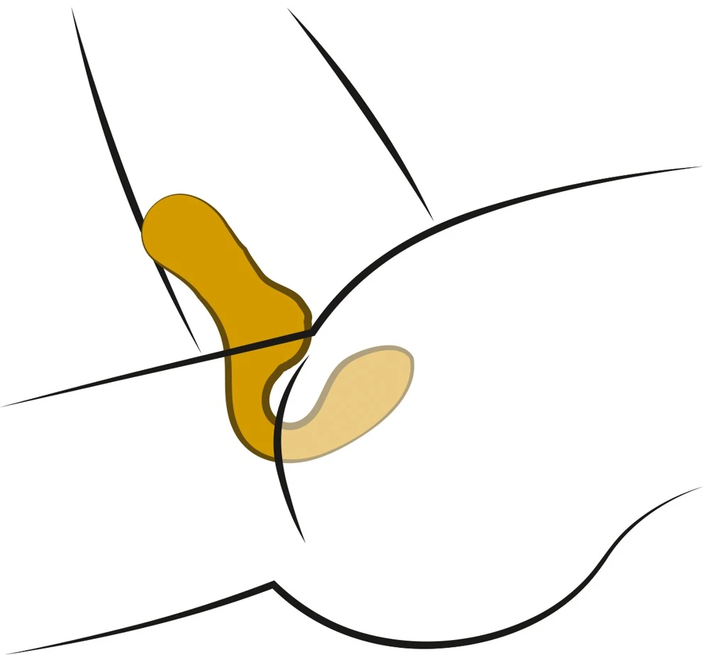 Dynamische dubbele vibrator met clitorale stimulatie